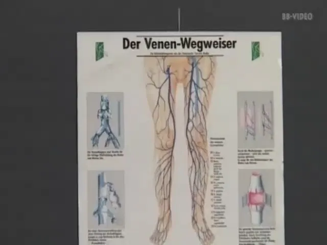 European Woman Blowjob Hardcore 3p/4p Clinic Sex