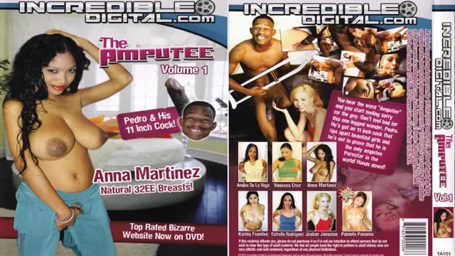 Amputee